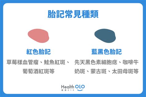 嬰兒胎記|胎記怎麼產生、何時消除？醫師剖析胎記種類、胎記寓意